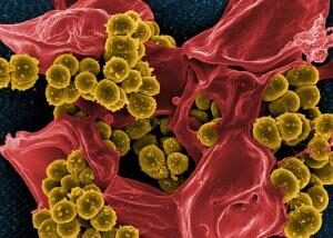 Methicillin-resistant Staphylococcus aureus and a dead human neutrophil